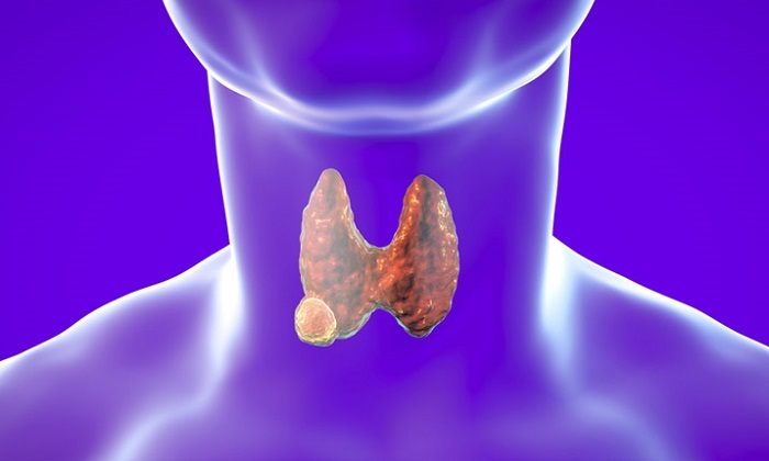 thyroidnodulecancer.jpg